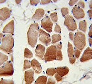 IHC testing of FFPE human skeletal muscle tissue with RuvB-like 1 antibody. HIER: steam section in p