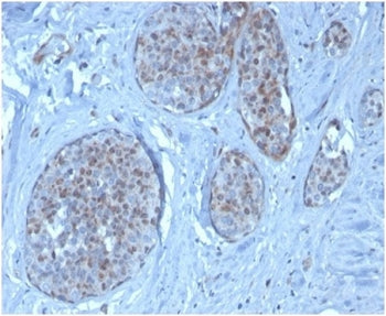 MDM2 Antibody