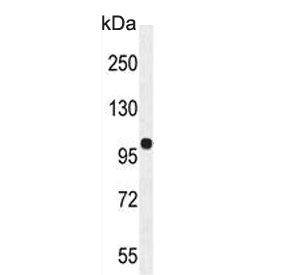 Western blot testing of mouse kidney lysate with Estrogen-induced gene 121-like protein antibody. Pr