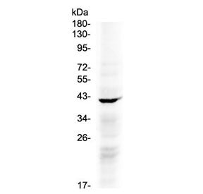 NDRG3 Antibody