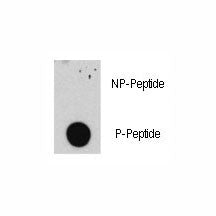 Dot blot analysis of phospho-E2F1 antibody. 50ng of phos-peptide or nonphos-peptide per dot were spo
