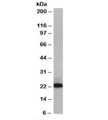Western blot testing of Jurkat lysate with MAX antibody at 0.1ug/ml. Two forms of MAX may be observe