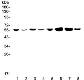 Western blot testing of human 1) Jurkat, 2) HepG2, 3) MCF7, 4) U-87 MG, 5) CCRF-CEM, 6) rat brain, 7