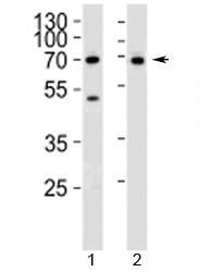 Western blot analysis of lysate from 1) Jurkat and 2) SK-BR-3 cell line using CD46 antibody at 1:100