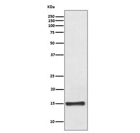 Western blot testing of human fetal heart lysate with FABP4 antibody. Predicted molecular weight ~15