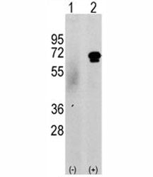 Western blot analysis of CAMKK2 antibody and 293 cell lysate either nontransfected (c) or transientl