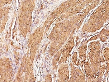 Actin Antibody (pan muscle)