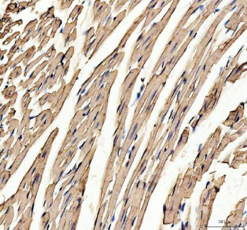 IHC staining of FFPE mouse heart tissue with Myoglobin antibody. HIER: boil tissue sections in pH8 E
