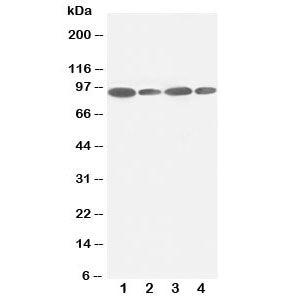 Western blot testing of FES antibody and Lane 1: HeLa; 2: 293T; 3: SKOV; 4: A549 lysate. Predicted m