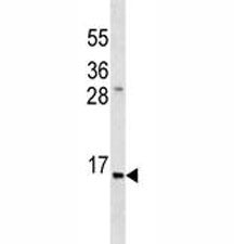 Insulin Antibody, 0.08ml