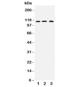 Western blot testing of human 1) COLO320, 2) MCF-7 and 3) PANC lysate with TRPC4 antibody at 0.5ug/m