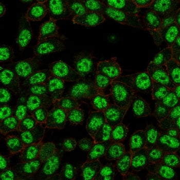 Immunofluorescent staining of PFA-fixed human HeLa cells using RELA antibody (green, clone PCRP-RELA
