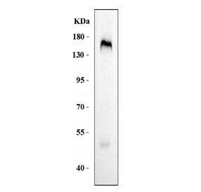 Western blot testing of human placental tissue lysate with CD163 antibody. Predicted molecular weigh