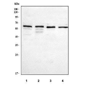 Western blot testing of Perforin antibody and Lane 1: HeLa; 2: COLO320; 3: HEPG2. Predicted/observed
