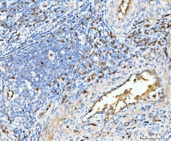 Hemoglobin subunit alpha Antibody / HBA1/2