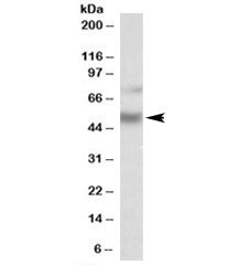 Western blot testing of human hippocampus lysate with ULK3 antibody at 1ug/ml. Predicted molecular w