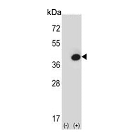 Western blot testing of 1) non-transfected and 2) transfected 293 cell lysate with Fructose-1,6-bisp