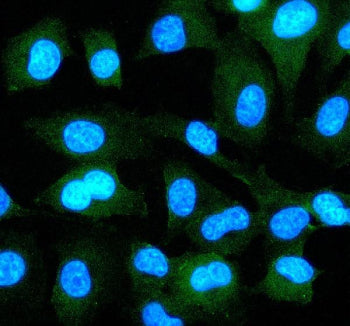 Immunofluorescent staining of EPS8 using anti-EPS8 antibody (green). EPS8 was detected in an immunoc
