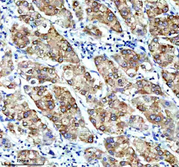 Immunohistochemical staining of CBR1 using anti-CBR1 antibody. CBR1 was detected in a paraffin-embed
