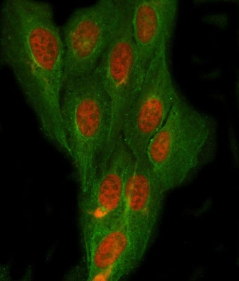 Immunofluorescent staining of FFPE human U-2 OS cells with NDRG4 antibody (red) and Beta Tubulin mAb