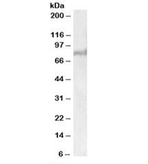Western blot testing of human liver lysate with ABCD2 antibody at 1ug/ml. Predicted molecular weight