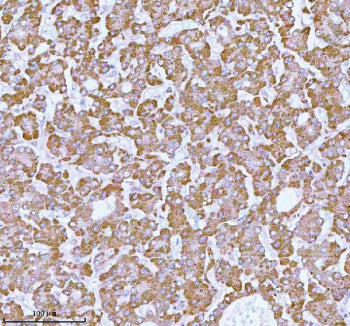 Immunohistochemical staining of using anti-ME3 antibody. ME3 was detected in a paraffin-embedded sec
