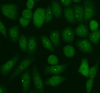 Immunofluorescent staining of FFPE human SiHa cells with PER1 antibody (green). HIER: steam section 