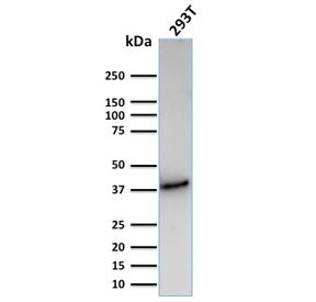 CD74 / CLIP Antibody