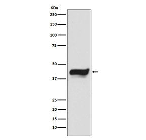 Western blot testing of human HeLa cell lysate with IKB epsilon antibody. Expected molecular weight: