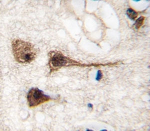 IHC analysis of FFPE human brain tissue stained with MEF2C antibody