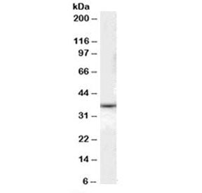 Western blot testing of human liver lysate with DARC antibody at 0.1ug/ml. Predicted molecular weigh