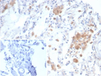 IHC staining of FFPE human lung tissue with Alpha 2 macroglobulin receptor antibody (clone LRP1/6784
