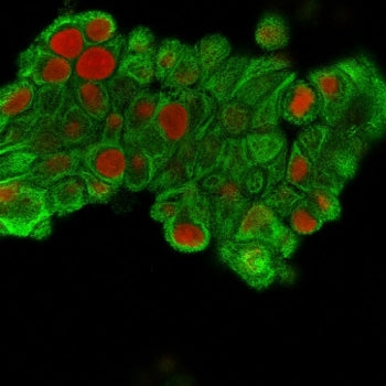 Immunofluorescent staining of MeOH fixed human MCF7 cells with Cytokeratin 19 antibody (clone SPM561