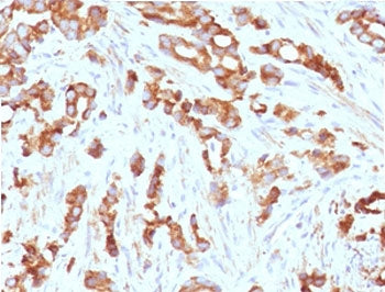 IHC testing of FFPE human prostate tissue with AURKB antibody (clone ARRK2-1). HIER: boil tissue sec
