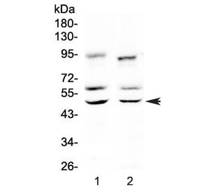 Western blot testing of 1) rat brain and 2) mouse brain lysate with CAMK2A antibody at 0.5ug/ml. Pre