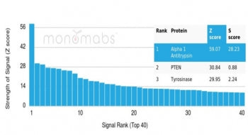 Analysis of a HuProt(TM) microarray containing more than 19,000 full-length human proteins using SER