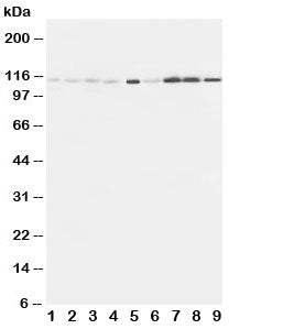 Western blot testing of EphA1 antibody and Lane 1: rat liver; 2: (r) lung; 3: (r) intestine; 4: (r) 