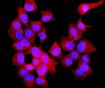 Immunofluorescent staining of FFPE human A431 cells with Annexin VII antibody (green) and DAPI nucle