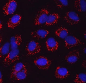 SARS2 Antibody / SerRS / Seryl-tRNA synthetase