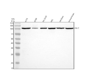 Western blot analysis of GALC using anti-GALC antibody. Electrophoresis was performed on a 10% SDS-P