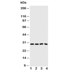 Western blot testing of Carbonic Anhydrase III antibody and Lane 1: SMMC-7721; 2: HeLa; 3: SW620; 4:
