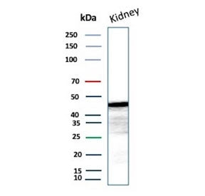 Western blot testing of human kidney tissue lysate with IDH1-R132G antibody (clone IDH1.R132G/13054R