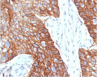 IHC staining of FFPE human cervical tissue with CD9 antibody (clone CDLA9-1). HIER: boil tissue sect