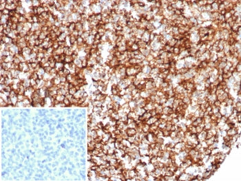 IHC staining of FFPE human tonsil tissue with recombinant CR1 antibody (clone rCR1/8599). Inset: PBS