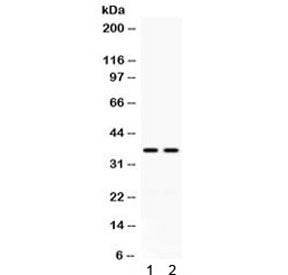 CD58 Antibody / LFA3