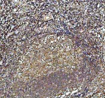 IHC staining of FFPE human tonsil with ARPC1B antibody. HIER: boil tissue sections in pH8 EDTA for 2