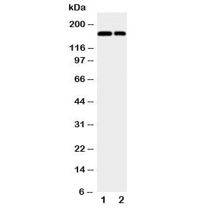 Western blot testing of CD11b antibody and Lane 1: Jurkat; 2: Raji; Observed molecular weight: 127~1