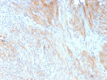 IHC staining of FFPE human uterus with Aciculin antibody (clone 14F8/F8). HIER: boil tissue sections