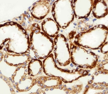IHC testing of FFPE human kidney tissue with MPP7 antibody. HIER: steam section in pH6 citrate buffe