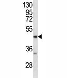 RAGE antibody western blot analysis in MDA-MB231 lysate. Predicted molecular weight: 45-55kDa depend